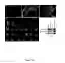 Fig. 03 - Methods for obtaining retinal progenitors, retinal pigmented epithelial cells and neural retinal cells