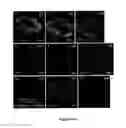 Fig. 08 - Methods for obtaining retinal progenitors, retinal pigmented epithelial cells and neural retinal cells