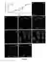 Fig. 12 - Methods for obtaining retinal progenitors, retinal pigmented epithelial cells and neural retinal cells