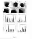 Fig. 14 - Methods for obtaining retinal progenitors, retinal pigmented epithelial cells and neural retinal cells