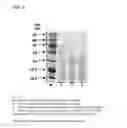 Fig. 07 - Coryneform bacterium and method for producing heterologous fusion proteins
