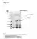 Fig. 15 - Coryneform bacterium and method for producing heterologous fusion proteins