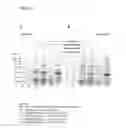 Fig. 20 - Coryneform bacterium and method for producing heterologous fusion proteins