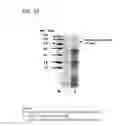 Fig. 24 - Coryneform bacterium and method for producing heterologous fusion proteins