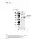 Fig. 25 - Coryneform bacterium and method for producing heterologous fusion proteins