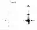 Fig. 09 - System for expression of genes in plants