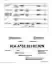 Fig. 02 - Method and kit for multiplex DNA typing of HLA gene