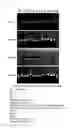 Fig. 09 - Method and kit for multiplex DNA typing of HLA gene