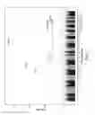 Fig. 02 - Methods for predicting risk of interstitial pneumonia