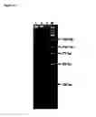 Fig. 15 - Amplification and Sequencing of Transrenal Nucleic Acids