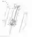 Fig. 07 - Ingot raw material supply system