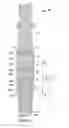 Fig. 03 - Sucker rod apparatus and method