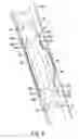 Fig. 04 - Centralizer and associated devices