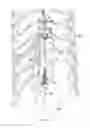 Fig. 09 - Riser tension protector and method of use thereof