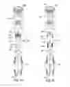 Fig. 08 - Radial conduit cutting system and method