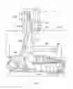 Fig. 04 - Gas turbine engine anti-icing system