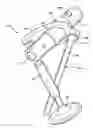 Fig. 01 - Rocker arm assembly and valvetrain assembly incorporating the same