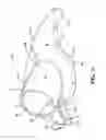 Fig. 06 - Rocker arm assembly and valvetrain assembly incorporating the same