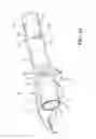 Fig. 15 - Valvetrain assembly
