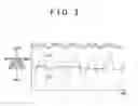 Fig. 04 - Control apparatus for internal combustion engine