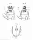 Fig. 10 - Actuation device for moving a movable cover of a thrust reverser