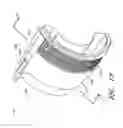 Fig. 14 - Nacelle