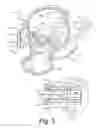 Fig. 04 - Turbine wastegate