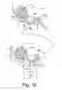 Fig. 11 - Turbine wastegate