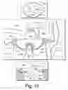Fig. 14 - Turbine wastegate