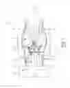 Fig. 02 - Compressor rotor with anti-vortex fins