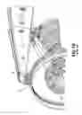 Fig. 02 - Barrel nut with stress reduction features