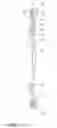 Fig. 08 - Lock-up device for torque converter
