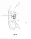 Fig. 03 - POSITIONING SYSTEM AND DEVICE FOR ARCHERY BOW STABILIZERS