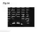 Fig. 04 - METHOD OF COLLECTING OF RARE CELLS FROM THE ENCLOSED FILTERS SYSTEM