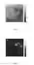 Fig. 06 - Device for optical coherence tomography