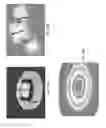 Fig. 37 - Device for capture of particles in a flow