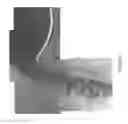 Fig. 41 - Device for capture of particles in a flow