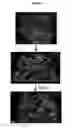 Fig. 02 - Treatment of inflammatory diseases