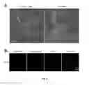 Fig. 14 - METHODS FOR DETECTING INFLAMMATORY DISORDERS
