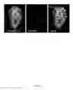 Fig. 22 - Rationale, methods, and assays for identifying human and non-human primate taste specific genes and use thereof in taste modulator and therapeutic screening assays