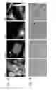 Fig. 02 - Methods for detecting and treating cancer metastasis