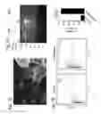 Fig. 03 - Methods for detecting and treating cancer metastasis