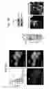 Fig. 05 - Methods for detecting and treating cancer metastasis