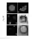 Fig. 08 - Methods for detecting and treating cancer metastasis