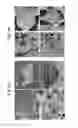 Fig. 10 - Methods for detecting and treating cancer metastasis