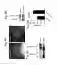 Fig. 16 - Methods for detecting and treating cancer metastasis