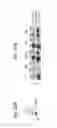 Fig. 35 - Methods for detecting and treating cancer metastasis