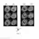 Fig. 08 - Mapping cardiac tissue architecture systems and methods