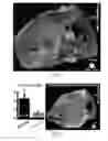 Fig. 04 - SHEET TRACTOGRAPHY USING DIFFUSION TENSOR MRI