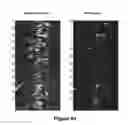 Fig. 15 - Moving multi-polarization multi-transmitter/receiver ground penetrating radar system and signal processing for buried target detection